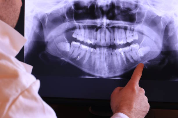 Best Dentist for Tooth Abscess  in Port Vue, PA